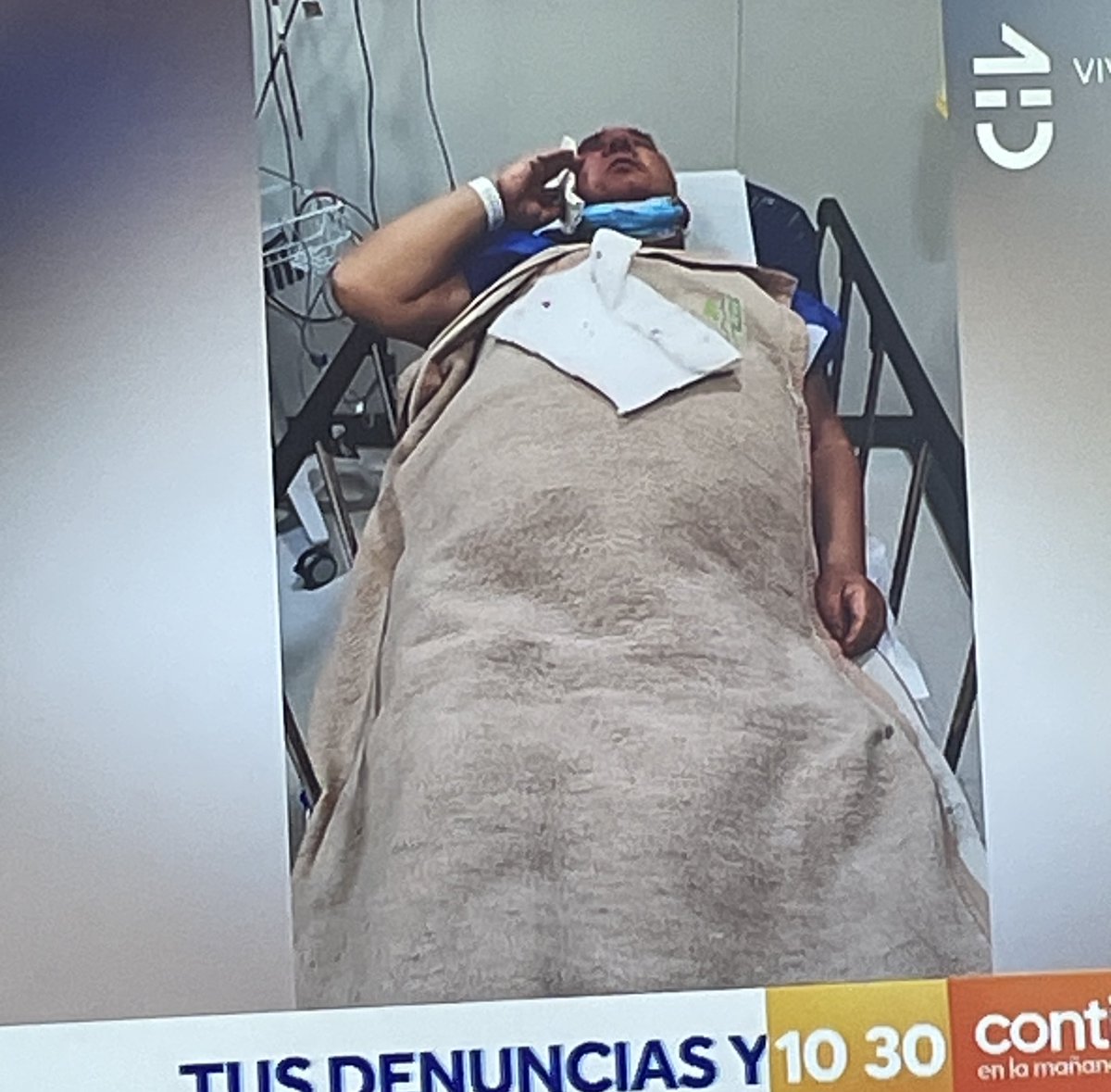 📢Funa: Martin de los santos Lehman golpeó brutalmente a un conserje de 70 años de un edificio en Vitacura le destrozó la mandíbula y el caballero está apunto de perder un ojo sicópata está inubicable y cerró todas sus REDES sociales Pero Aquí su teléfono +56 9 7382 6094✌️