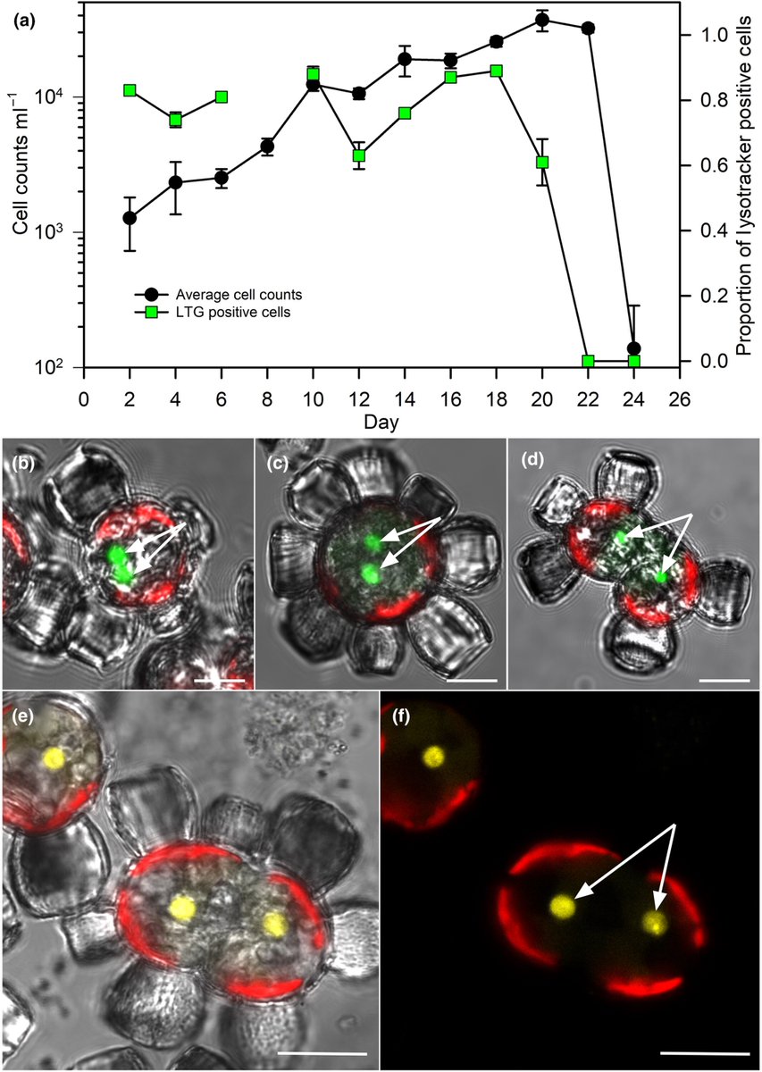 Study from Microbial Ecophysiology Group, <a href="/UNCWilmington/">UNCW</a>'s Alison Taylor lab, reveals the 1st evidence of chlorophagy in marine phytoplankton, showing how coccolithophores-"Scyphosphaera apsteinii" use a novel organelle to digest prey &amp; recycle nutrients. doi.org/10.1111/nph.20…