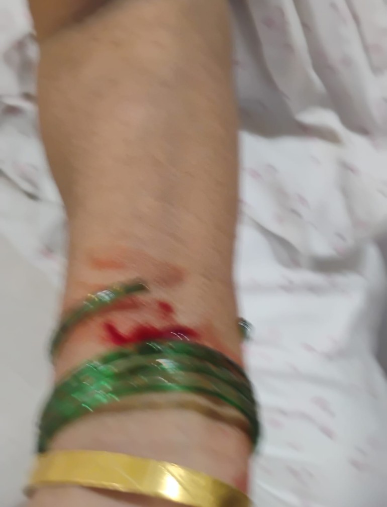 prakashm99 (@prakashm99) on Twitter photo Today atound 9.30 pm one of the widow and senior citizen smt .vidya pagare resident of shastri nagar near vartak nagar thane is badly assaulted by knief by her daughter in law and is hospitalized due to severe injuries on face and body. <a href="/ThaneCityPolice/">Thane City Police -ठाणे शहर पोलीस</a> plz take action. Today atound 9.30 pm one of the widow and senior citizen smt .vidya pagare resident of shastri nagar near vartak nagar thane is badly assaulted by knief by her daughter in law and is hospitalized due to severe injuries on face and body. <a href="/ThaneCityPolice/">Thane City Police -ठाणे शहर पोलीस</a> plz take action.