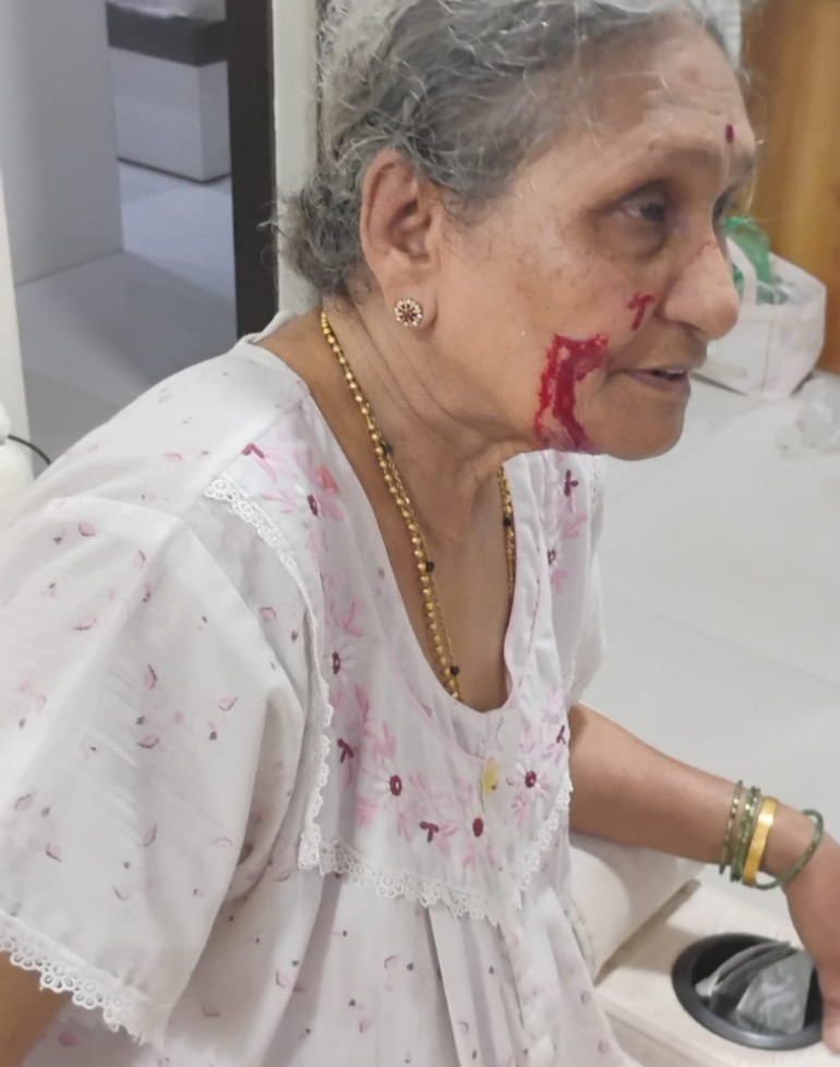 prakashm99's tweet photo. Today atound  9.30 pm one of the widow and senior citizen smt .vidya pagare resident of shastri nagar near vartak nagar thane is badly assaulted by knief by her daughter in law and is hospitalized due to severe injuries on face and body. @ThaneCityPolice plz take action. https://t.co/7rIywYr0YO
