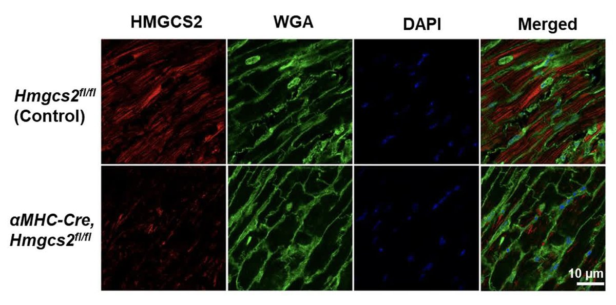 Circulation Research (@circres) on Twitter photo Kaoy et al found #HMGCS2 mediates the therapeutic effects of #NAD+ therapy in #HFpEF by restoring normal lipid metabolism & improving mitochondrial function in the heart. ahajrnls.org/4k2nj9b
<a href="/yen_koay/">Yen Chin Koay</a> <a href="/realjosullivan/">John O'Sullivan</a> <a href="/AshishMisraLab/">Ashish Misra</a> <a href="/chenchenwenwen/">Chenchenwenwen</a> Kaoy et al found #HMGCS2 mediates the therapeutic effects of #NAD+ therapy in #HFpEF by restoring normal lipid metabolism & improving mitochondrial function in the heart. ahajrnls.org/4k2nj9b
<a href="/yen_koay/">Yen Chin Koay</a> <a href="/realjosullivan/">John O'Sullivan</a> <a href="/AshishMisraLab/">Ashish Misra</a> <a href="/chenchenwenwen/">Chenchenwenwen</a>