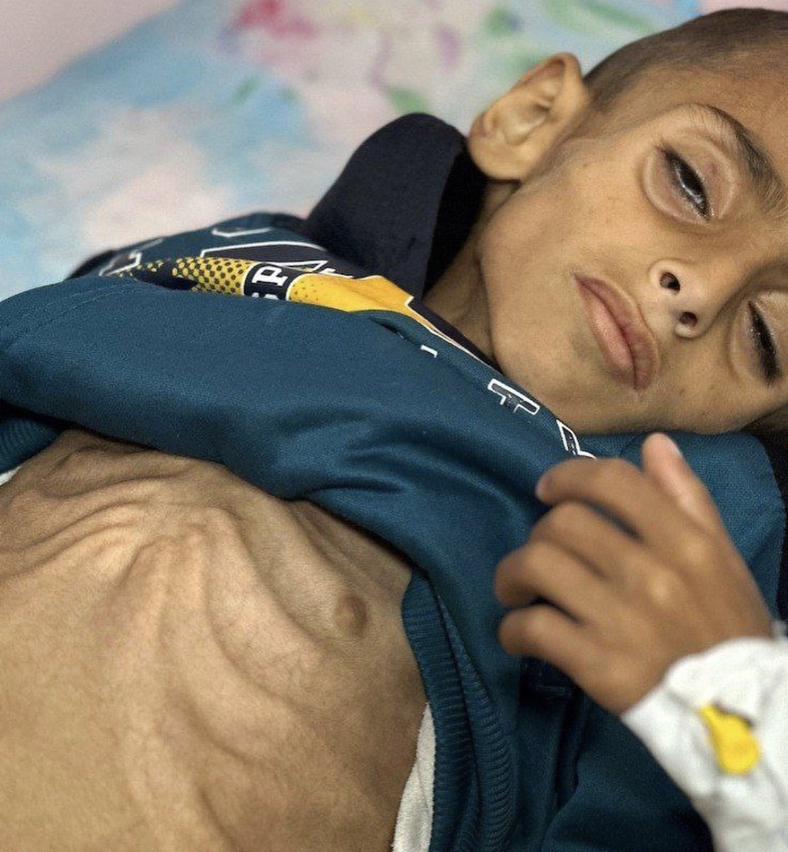 yousef_ki1's tweet photo. He is starving.
If you see this little angel, reply with 🇵🇸 pray for him 💔 https://t.co/3z8gdb07gP