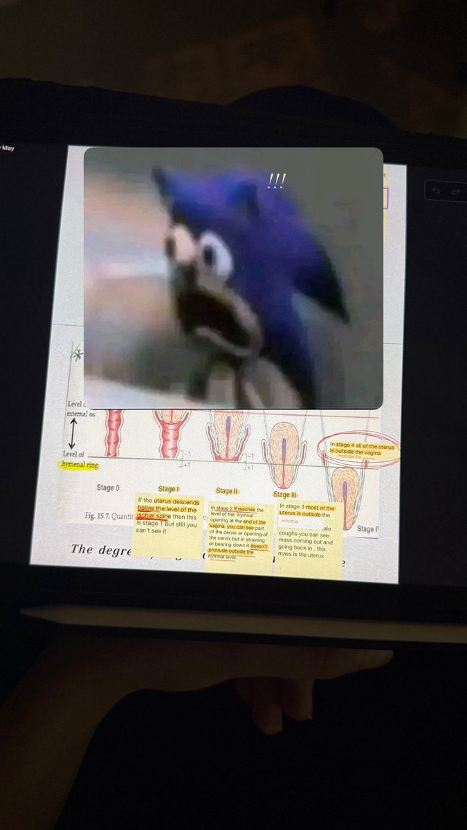 Happily announcing that we have finally finished OB/GYN 1 
👏🏻🥳