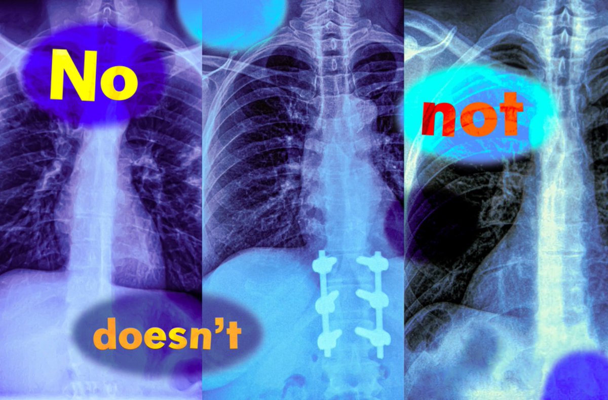 Kenneth21655592's tweet image. Study shows vision-language models can’t handle queries with negation words
#AI #AIRadiology #Artificialintelligence #MachineLearning #LLMs #medicine #MedEd #MedTwitter #MedX #RadEd @MIT
news.mit.edu/2025/study-sho…