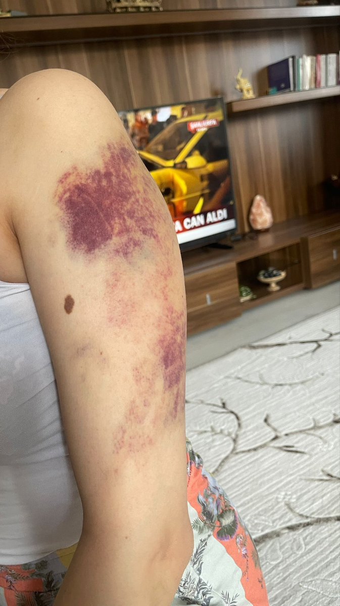 Aklım da vicdanım da kabul etmiyor bu kadarını artık. Her seferinde kadın şiddeti, cinayeti haberi gördüğümde yakınıma, kardeşime, ablama yapılmış gibi kahroluyordum. Bu sefer gerçekten yakınıma oldu… Bir kadın düşünün eşi olacak bir canavar ve o canavarı yaratan ailesi