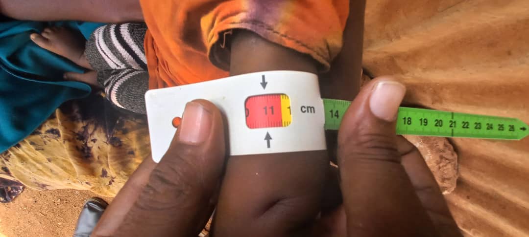 CODHNET's tweet image. In #Somalia, every day counts as the climate crisis worsens.
@CoDHNet, with @MoHSWSom, delivers urgent health &amp;amp; nutrition support to hard-to-reach families—saving lives &amp;amp; reducing vulnerability.

#ClimateCrisis #HealthForAll #Somalia #Nutrition #HumanitarianAid