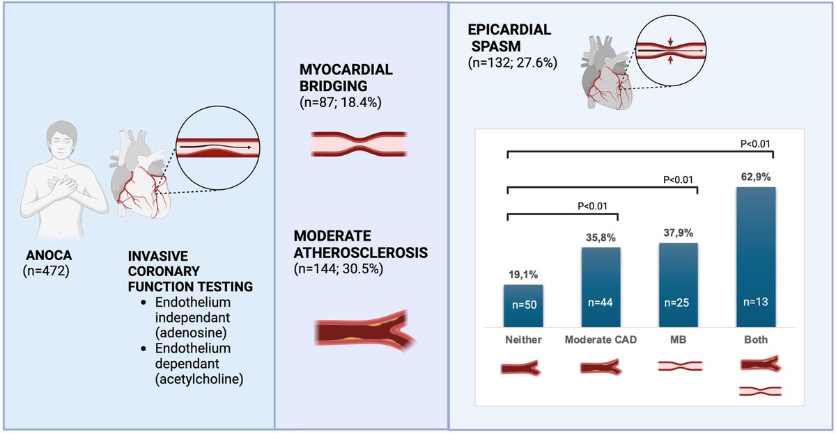 MyJSCAI (@myjscai) on Twitter photo 📖In patients w #INOCA, epicardial spasm occurs more often in patients w both #myocardial bridging & moderate #atherosclerosis 💡Read this original research study today:
➡️doi.org/10.1016/j.jsca…
@StevenMiner1967 <a href="/ProulxBoivin_LA/">Laurie-Anne Boivin-Proulx</a> <a href="/JBlairMD/">John Blair</a> <a href="/AlexBastiany/">Alex Bastiany, MD</a> 📖In patients w #INOCA, epicardial spasm occurs more often in patients w both #myocardial bridging & moderate #atherosclerosis 💡Read this original research study today:
➡️doi.org/10.1016/j.jsca…
@StevenMiner1967 <a href="/ProulxBoivin_LA/">Laurie-Anne Boivin-Proulx</a> <a href="/JBlairMD/">John Blair</a> <a href="/AlexBastiany/">Alex Bastiany, MD</a>