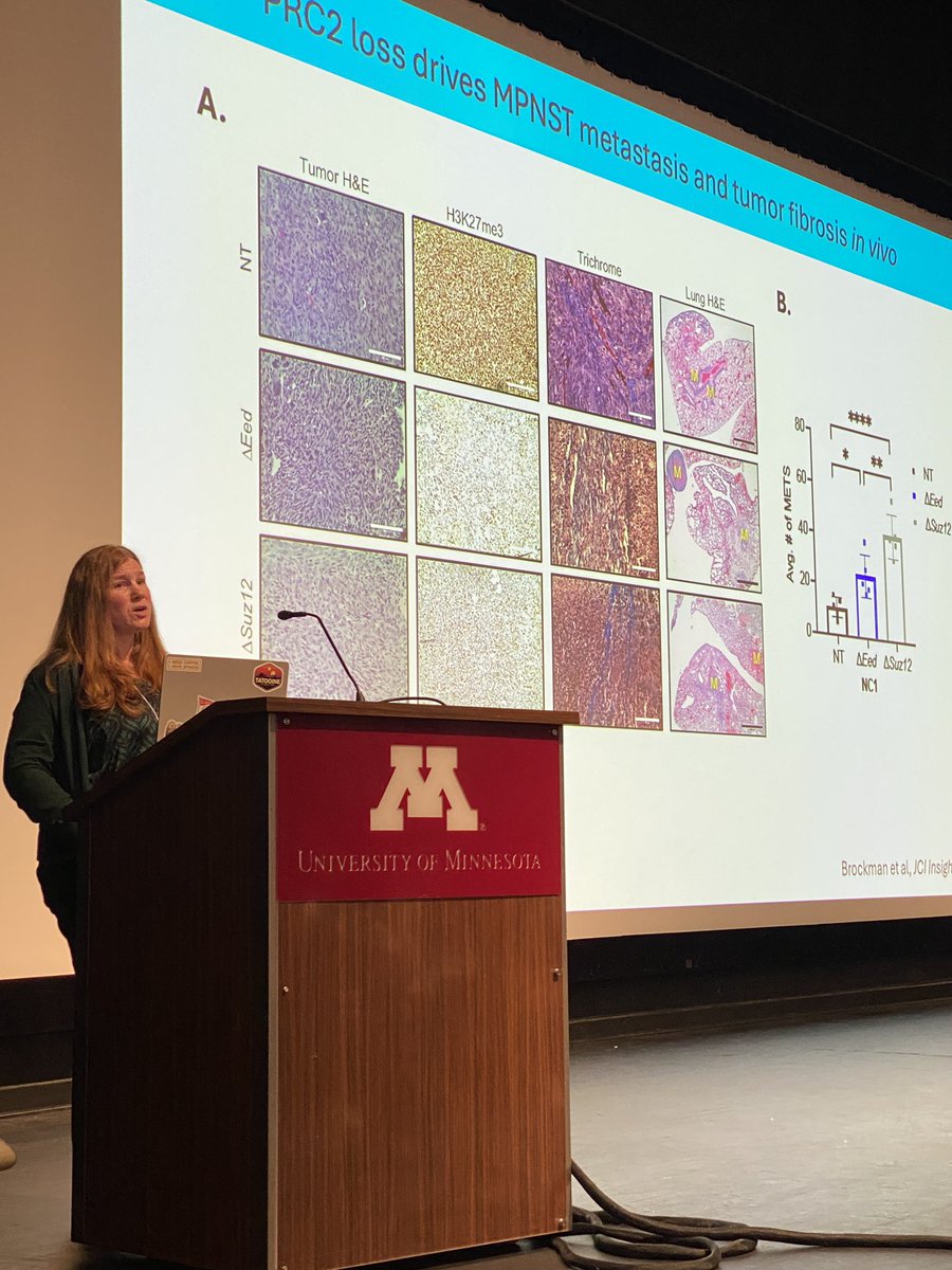 Paolo Provenzano (@ppproven) on Twitter photo Wonderful talk at #MidwestTME2025 from Rebecca Dodd (University of Iowa) on Sarcomas. <a href="/UIowaCancer/">UI Holden Comprehensive Cancer Center</a> Wonderful talk at #MidwestTME2025 from Rebecca Dodd (University of Iowa) on Sarcomas. <a href="/UIowaCancer/">UI Holden Comprehensive Cancer Center</a>