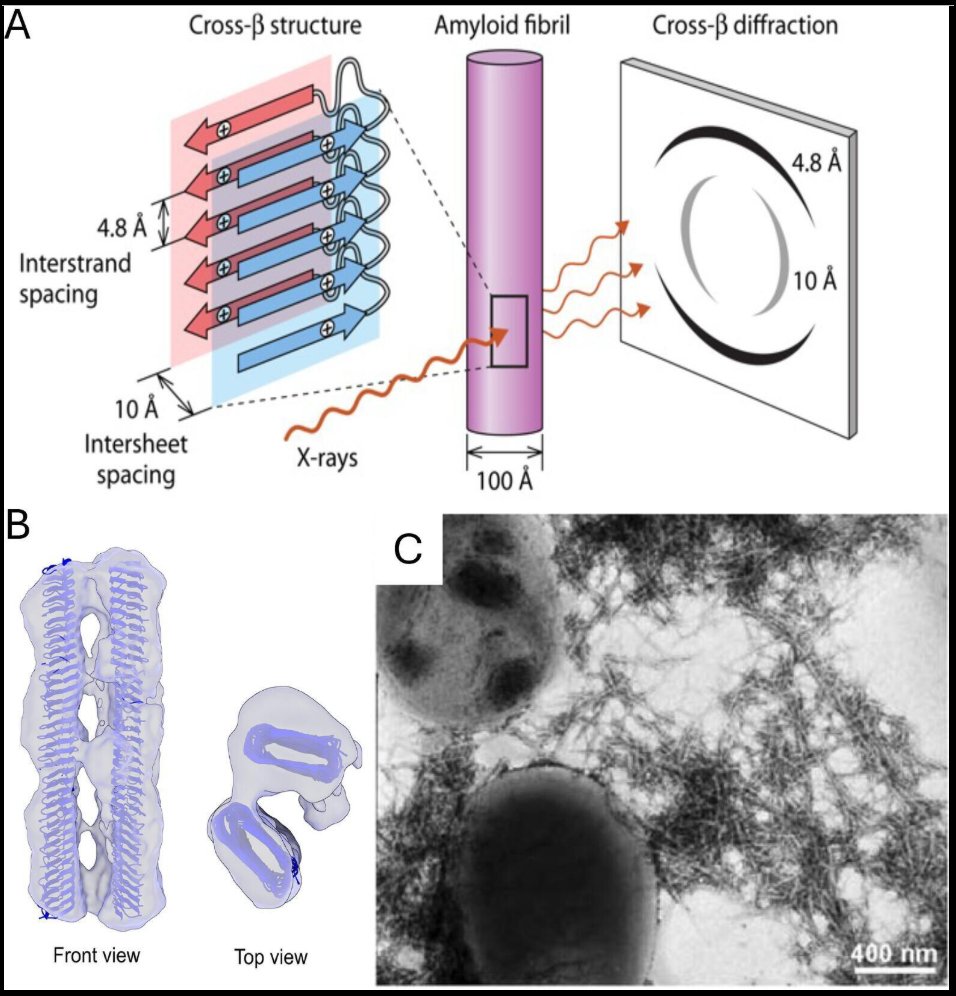 mBio (@mbiojournal) on Twitter photo The persistence & strength of #biofilms bedevil food & fuel processing and also drug resistance in disease. This #mBio minireview by Peter Lipke of <a href="/CUNY/">The City University of New York</a> shows that #amyloid-like bonding helps establish microbial biofilms and keeps them intact under flow. doi.org/10.1128/mbio.0… The persistence & strength of #biofilms bedevil food & fuel processing and also drug resistance in disease. This #mBio minireview by Peter Lipke of <a href="/CUNY/">The City University of New York</a> shows that #amyloid-like bonding helps establish microbial biofilms and keeps them intact under flow. doi.org/10.1128/mbio.0…