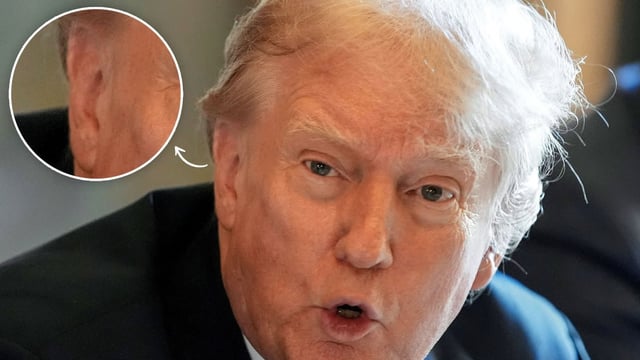 BlackKnight10k's tweet photo. If you want to play that game, let's subpoena Trump's physician because there's no bullet wound https://t.co/cwAEvoFm0S