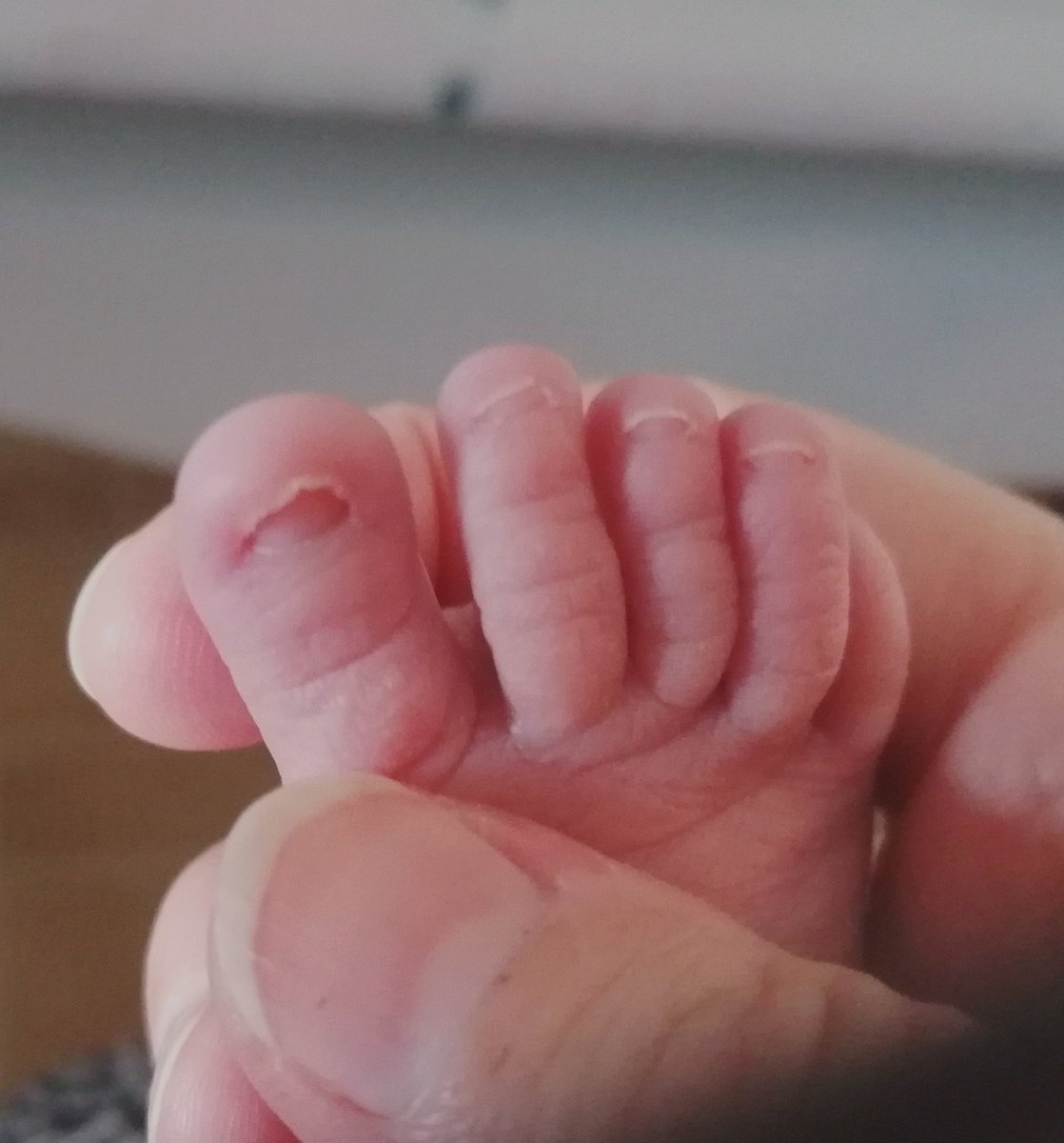 They're SO tiny! My thumbnail fits the entire big toe 👀