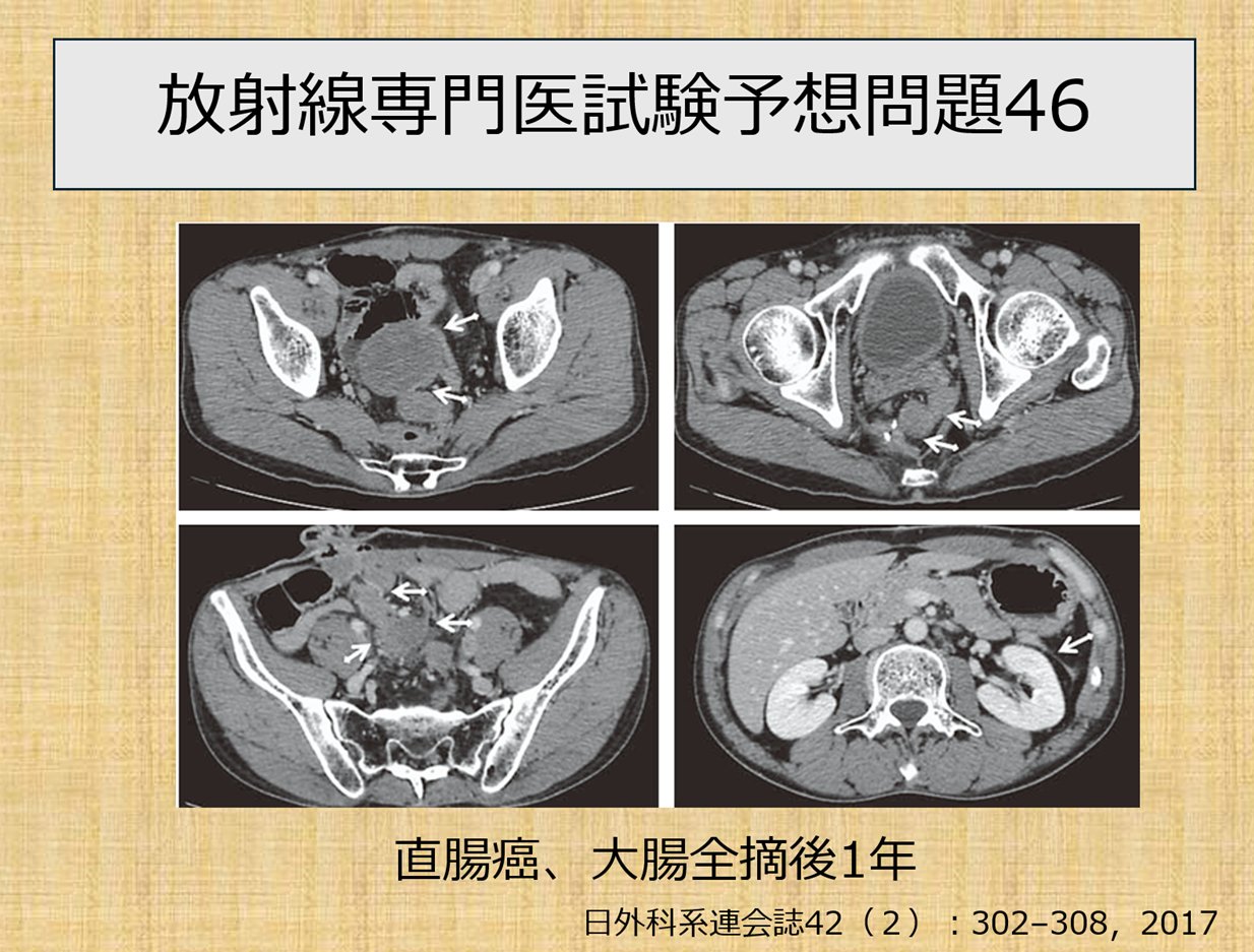 医用放射線辞典 第6版 本