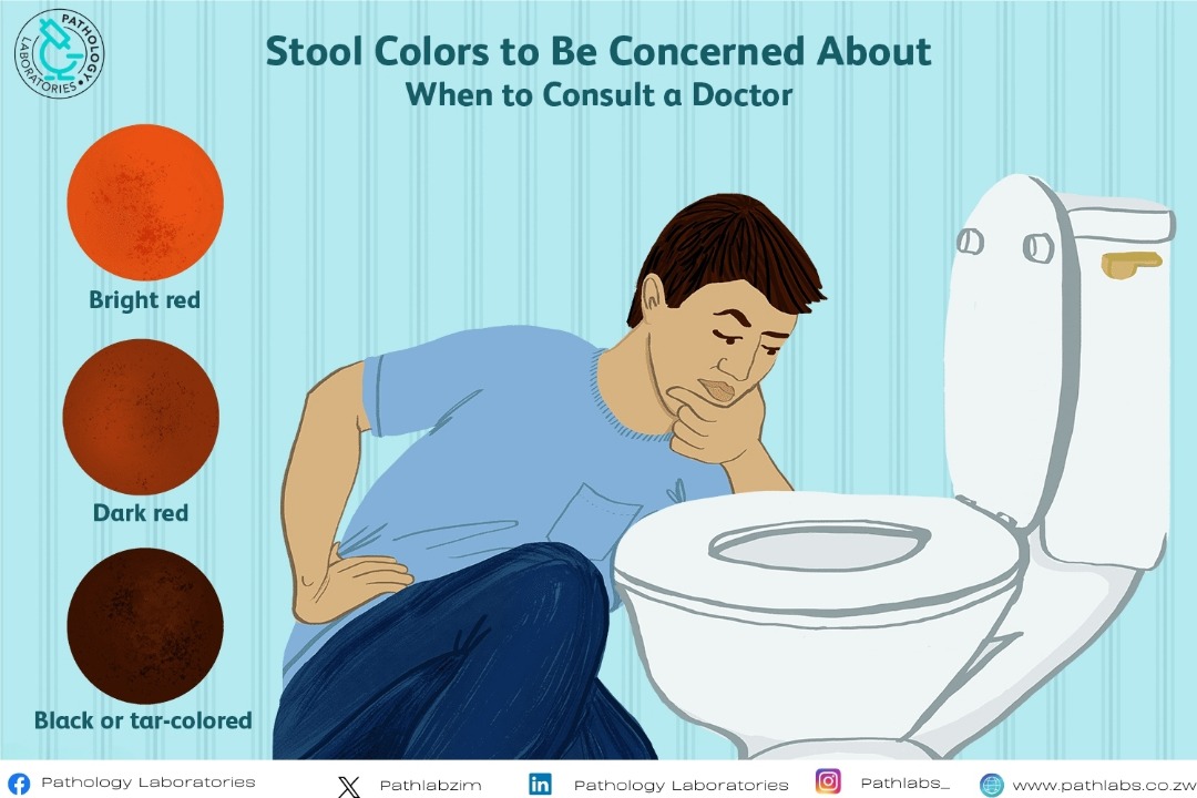 Pathlabzim's tweet image. Truth stinks, but did you know your stool holds secrets about your health? It reveals digestive health, gut health, and much more! 

Regular check-ups can help you stay on track for a healthier you!

 #StayHealthy 
#HealthAwareness
#wecare
#confidentdiagnosis