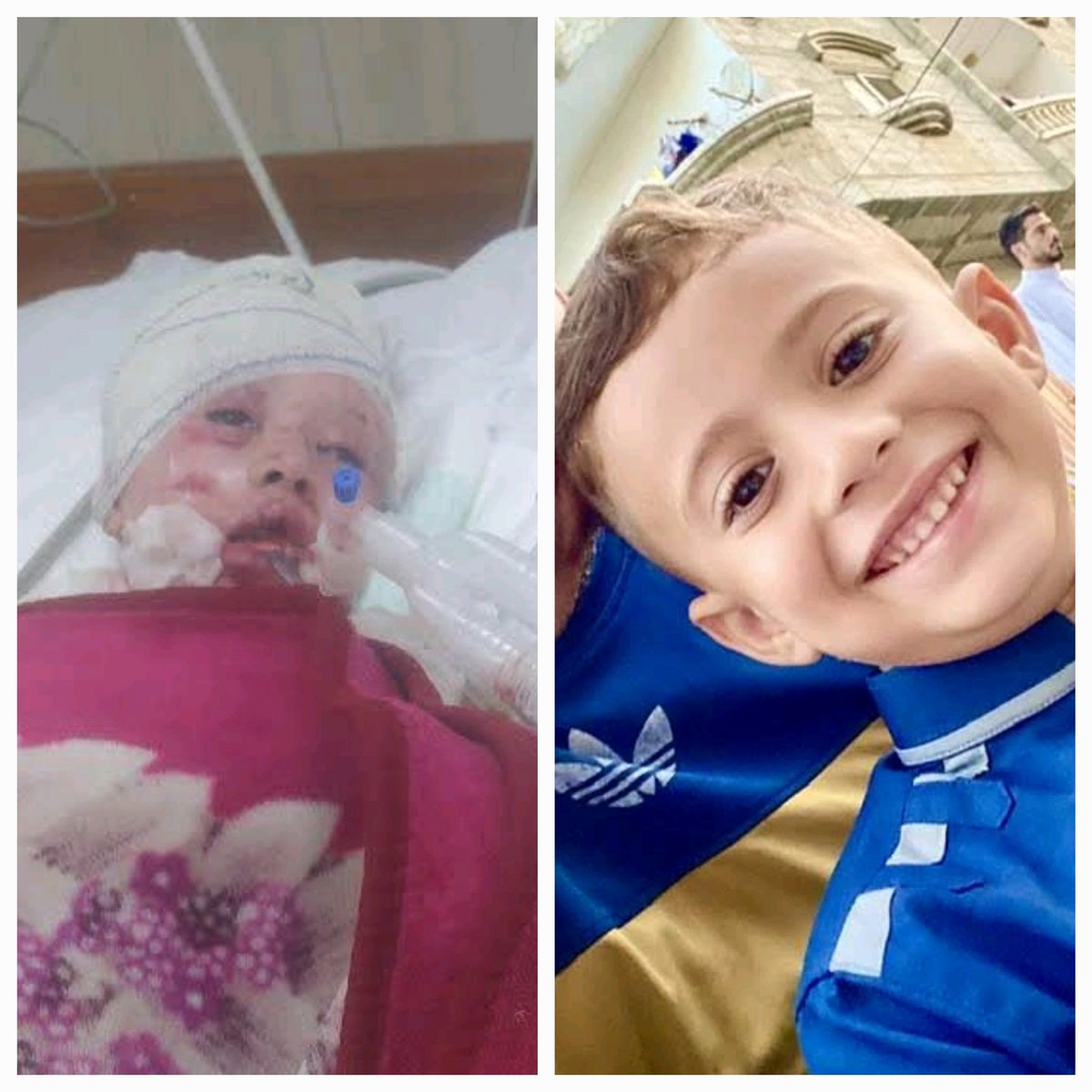 الطفل عمر جهاد الشريف
الناجي الوحيد من مجزرة مروعة استهدفت منزل عائلته، والتي أسفرت عن استشهاد والدته وجميع إخوته. عمر أُصيب بحروق بالغة وخطيرة، ويصارع الموت الآن.  

حالته حرجة للغاية ويحتاج إلى السفر الفوري لتلقي العلاج خارج قطاع غزة.  
النداء لكل الجهات الإنسانية والحقوقية