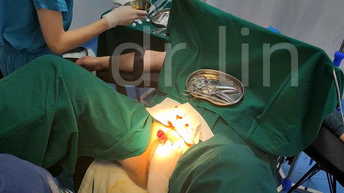 骚大叔希望医生操作他的包皮，少麻药感受自己的阴茎被医生操作，全身被束缚，想抬头观望只能看到医生冰冷的眼神。特殊病情特殊治疗，必须满足患者