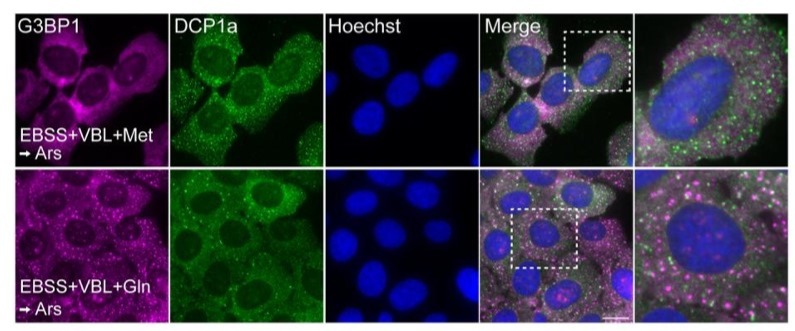 sreeparna_b's tweet image. Last week&apos;s papers on #cancer #metabolism and #glutamine via @Bims_BiomedNews 

biomed.news/bims-glucam/20…

Top pick: Glutamine modulates stress granule formation in cancer cells through core RNA-binding proteins pubmed.ncbi.nlm.nih.gov/40376753/