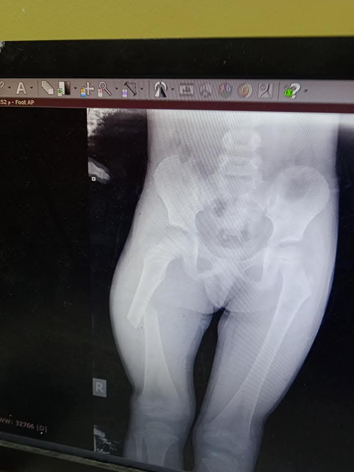 rv20g__'s tweet image. Please please help me please. This is my little baby💔💔
social.fund/hbnocf/?sw=2