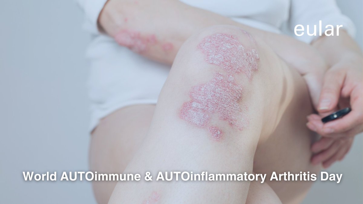📢 It´s World AUTOimmune &amp; AUTOinflammatory Arthritis Day!

Let’s raise awareness about autoimmune and autoinflammatory arthritis, conditions that can cause significant pain and impact daily life.

Support and help make a difference!

#eularADVOCACY #EULAR #TogetherForChange