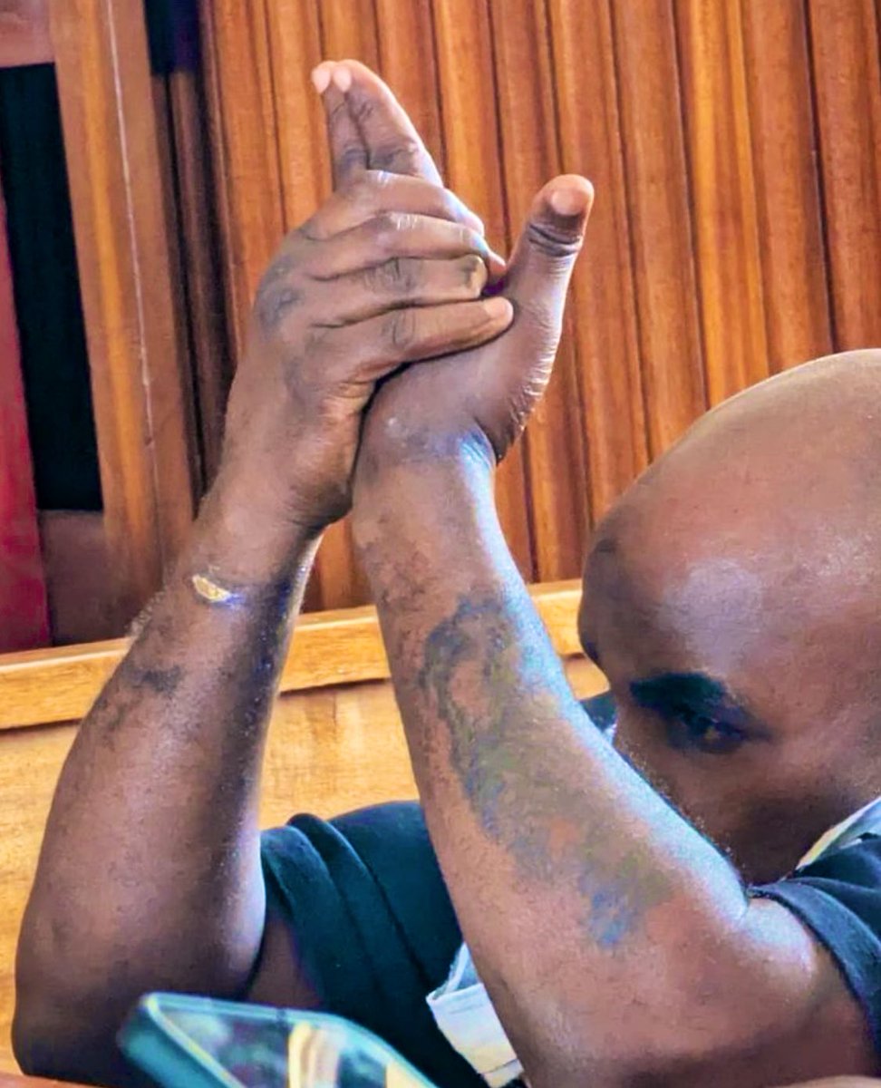 ROBERT MUNANUKYE ๐ท๐ผ ๐บ๐ฌ (@robertmunanukye) on Twitter photo The results of opposing a dictator
Comrade <a href="/eddie_mutwe/">Eddie Mutwe</a> lost one of his fingers
Oba Cidiefu remained with it for witchcraft ๐ค The results of opposing a dictator
Comrade <a href="/eddie_mutwe/">Eddie Mutwe</a> lost one of his fingers
Oba Cidiefu remained with it for witchcraft ๐ค