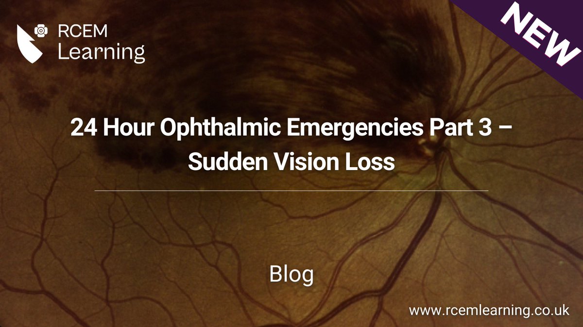 RCEMLearning (@rcemlearning) on Twitter photo NEW: The third #blog in our "24 Hour Ophthalmic Emergencies" summarises the assessment and initial management of common ophthalmic emergency presentation such as Sudden Vision Loss 
Read it here: rcemlearning.co.uk/foamed/24-hour… NEW: The third #blog in our "24 Hour Ophthalmic Emergencies" summarises the assessment and initial management of common ophthalmic emergency presentation such as Sudden Vision Loss 
Read it here: rcemlearning.co.uk/foamed/24-hour…