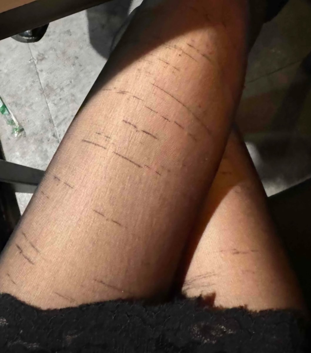 졸라 하등해
응 너ㅋ

#핀돔 #핀섭 #인간atm #상납