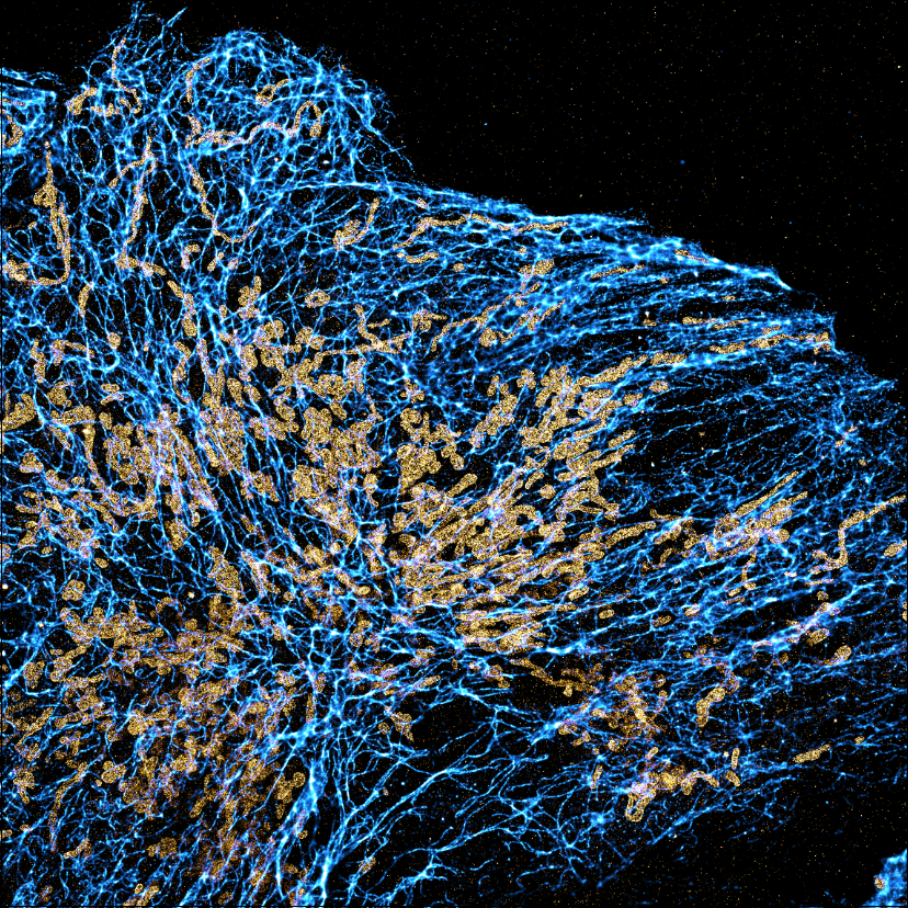 🔬 Curious about DNA-PAINT but don’t want to prep a sample? Need a reliable, high-quality #SMLM demo slide for your next workshop or training session?

Meet our Stable Cell Slide! A ready-to-image sample featuring dual-target labeling of mitochondria and vimentin, &amp; pre-incubated