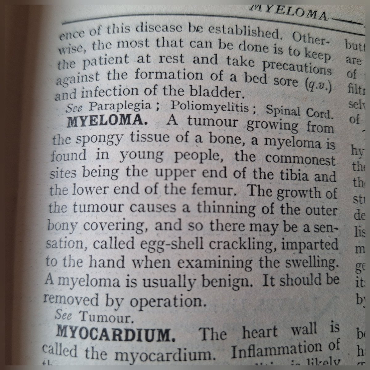 CRG-Haematology (@crghaem) on Twitter photo 1932 and look how very differently Myeloma was viewed back then.A researcher realised this back then creating a plethora of trials in this space...Fast forward to 2025, a malignant disease which many patients can outlive...Truly amazing <a href="/MyelomaUK/">Myeloma UK</a> #InternationalClinicalTrialsDay 1932 and look how very differently Myeloma was viewed back then.A researcher realised this back then creating a plethora of trials in this space...Fast forward to 2025, a malignant disease which many patients can outlive...Truly amazing <a href="/MyelomaUK/">Myeloma UK</a> #InternationalClinicalTrialsDay