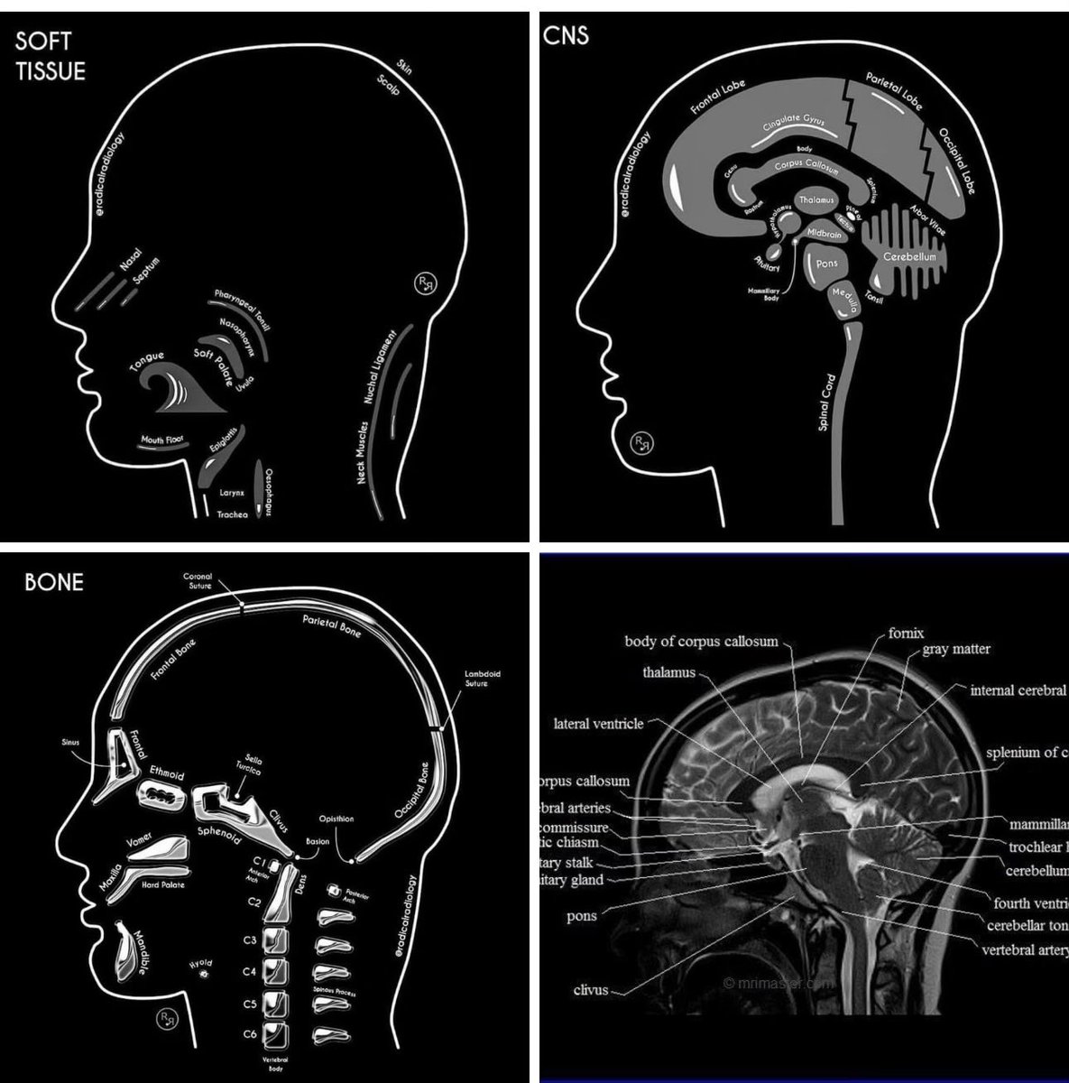 Brain