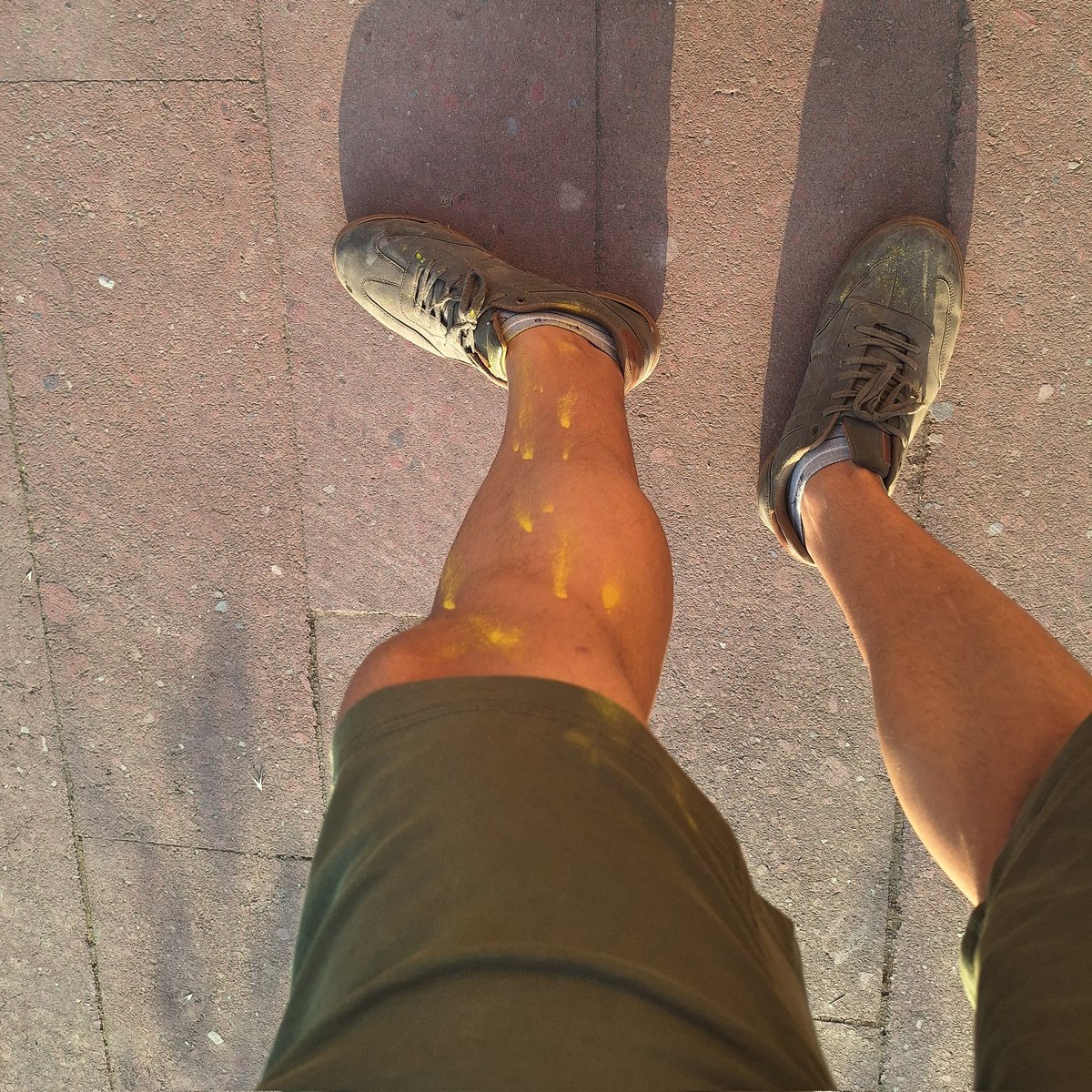 Theorhiew's tweet photo. The famous journalist Orhi Gundi was injured in his left leg at the Colorfest he attended. The famous journalist is reported to be in good condition. 
#journalist 
#Colorfest https://t.co/MlWFADCR4Q