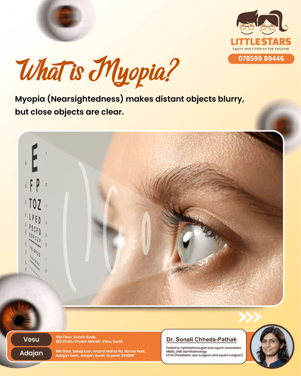 LittleStarsEye's tweet photo. Struggling to see the board or road signs? It could be myopia .
At Little Star Eye Hospital, Surat, we offer expert care for kids &amp; adults — glasses, contact lenses &amp; advanced treatment options.
📞+91 78599 89446
#MyopiaInChildren #EyeCareSurat #LittleStarEyeHospital https://t.co/lAfqrHGG31