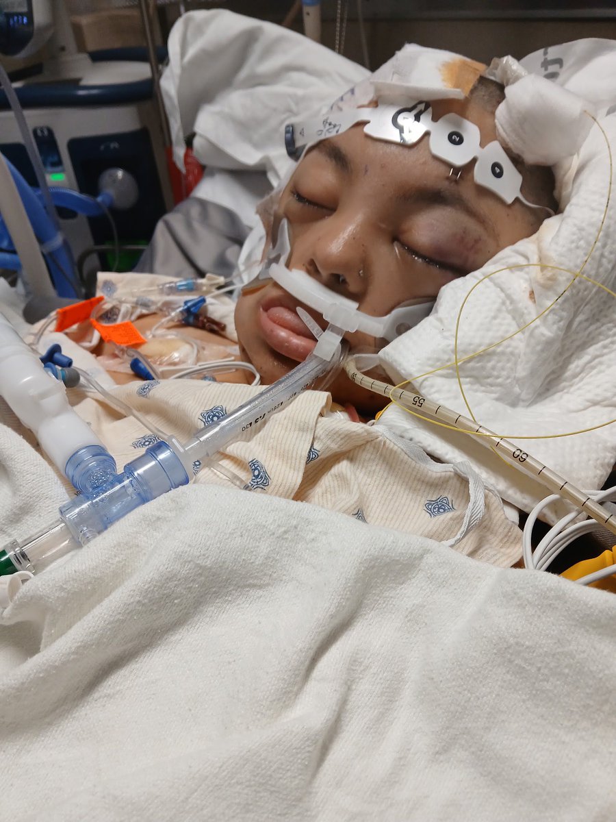 A 20-year-old woman struck by a vehicle in a hit-and-run incident in downtown Austin has died after being removed from life support, her family confirmed.

Full story ⬇️