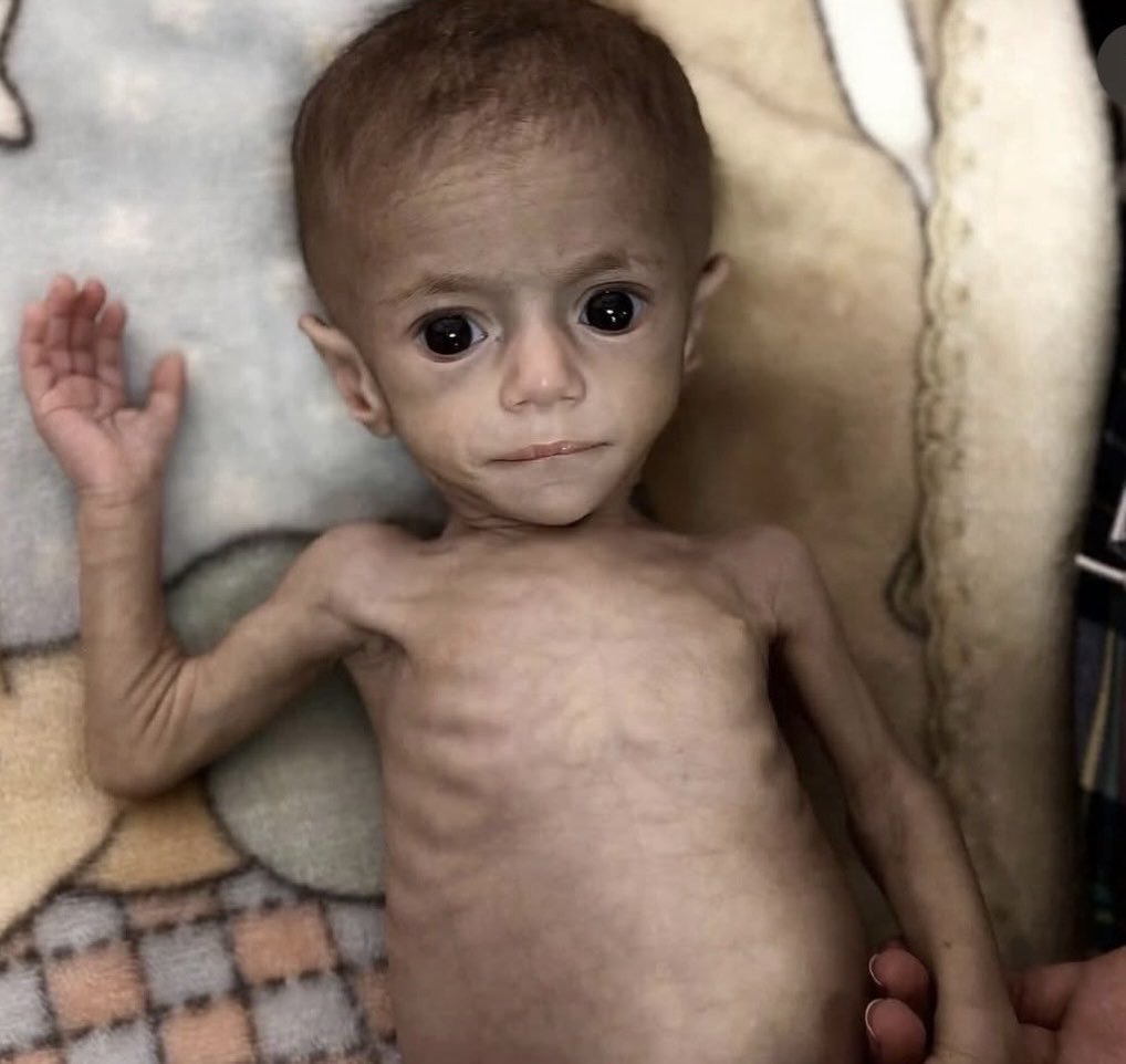 rulajebreal's tweet photo. L' ONU: “14.000 bambini palestinesi potrebbero morire di fame nelle prossime 48 ore”. 
Mentre gli israeliani condannano e danno del terrorista al generale 🇮🇱 Golan per aver detto:
“Uno Stato sano non uccide i bambini per hobby e non pianifica l'espulsione di una popolazione". https://t.co/DAzK84Ots8