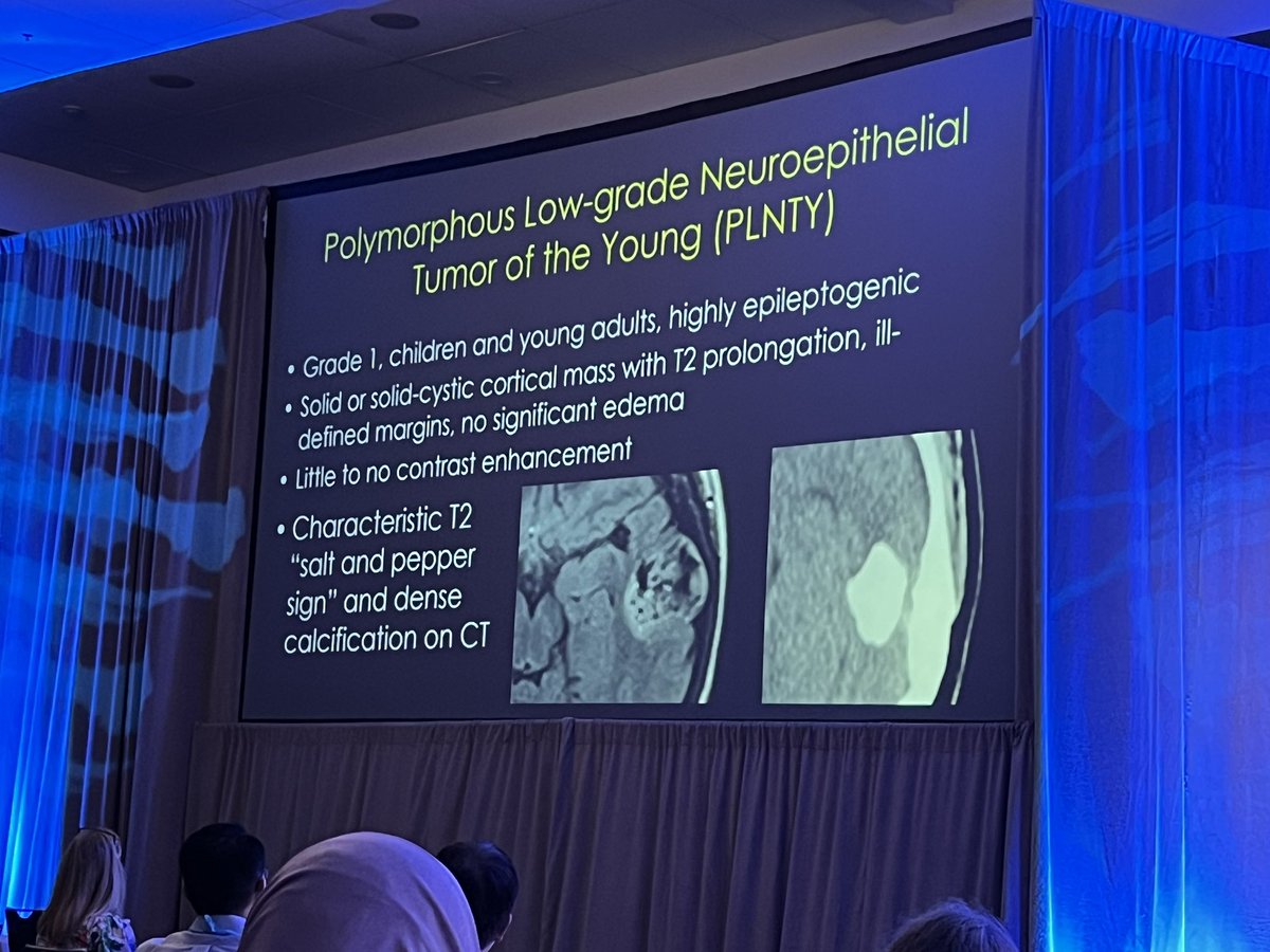 American Society of Pediatric Neuroradiology (@the_aspnr) on Twitter photo 🔥Rapid Fire #pedineurorad Cases🔥 brought to us by <a href="/ErinSchwartzMD/">Erin Simon Schwartz, MD, FACR (she/her)</a> at #ASNR25. Grab your coffee and let’s learn!
#pedrad #neurorad 🔥Rapid Fire #pedineurorad Cases🔥 brought to us by <a href="/ErinSchwartzMD/">Erin Simon Schwartz, MD, FACR (she/her)</a> at #ASNR25. Grab your coffee and let’s learn!
#pedrad #neurorad