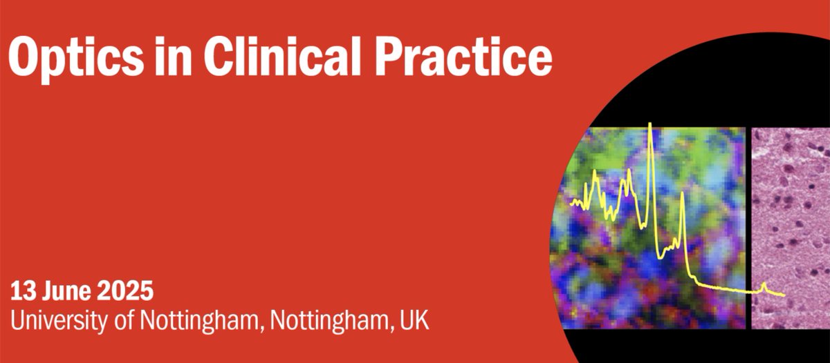 Michael Tanner (@tanner_labstuff) on Twitter photo Join us <a href="/IOPMED/">IOP Medical Physics Group</a> @IOPOpticalGroup <a href="/PhysicsNews/">Institute of Physics</a> in Nottingham on Friday 13th June discussing optics for clinical practice, with views from academics developing them and medical practitioners using them in the clinic.
Info: iop.eventsair.com/ocp2025/
Registration by: Monday 2nd June Join us <a href="/IOPMED/">IOP Medical Physics Group</a> @IOPOpticalGroup <a href="/PhysicsNews/">Institute of Physics</a> in Nottingham on Friday 13th June discussing optics for clinical practice, with views from academics developing them and medical practitioners using them in the clinic.
Info: iop.eventsair.com/ocp2025/
Registration by: Monday 2nd June