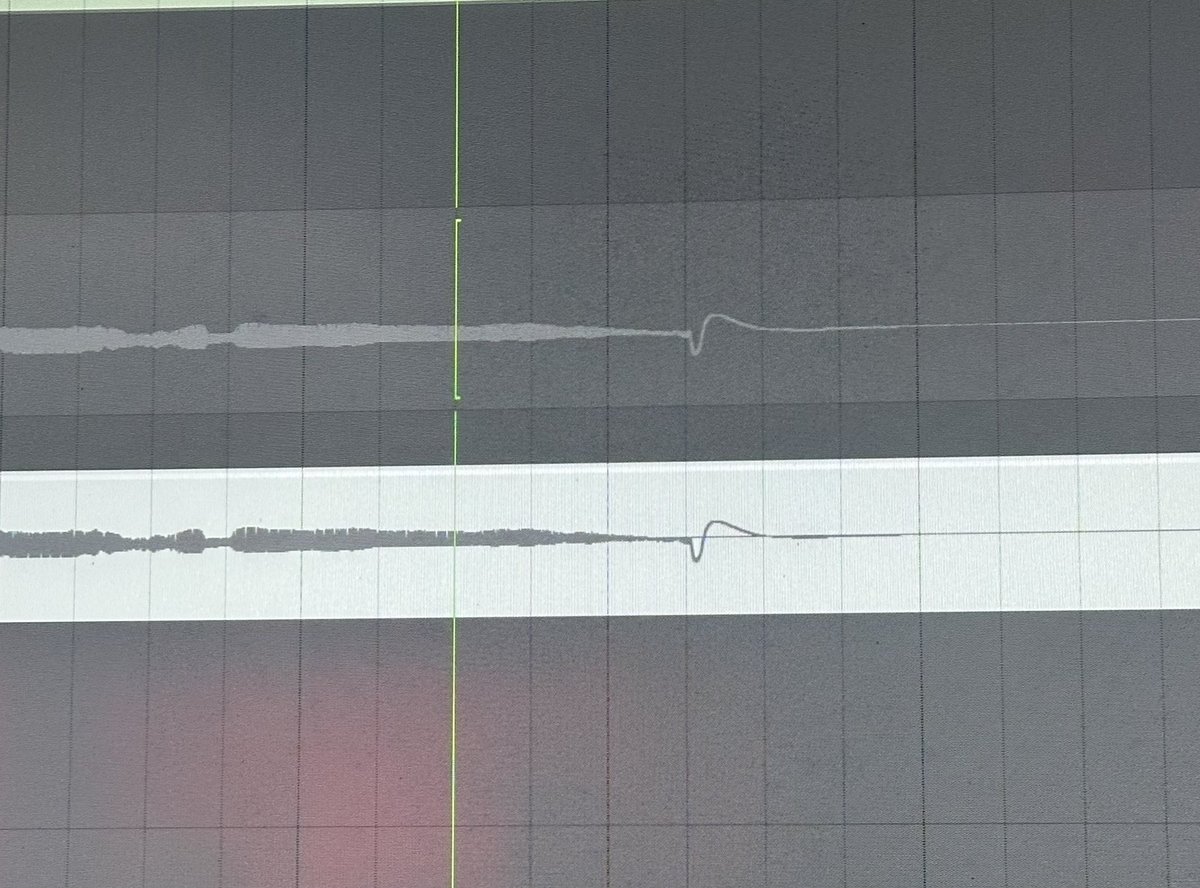 mikvanbag's tweet photo. Watch me whip #recording #homerecording #homestudio #writing #writingmusic #metal #8string #djentlemen https://t.co/lAXPq16KRV