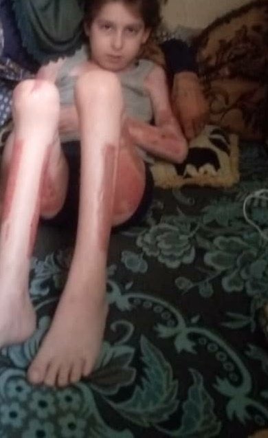 We’ve now raised $900 for the family from Homs ❤️

Just $300 to go to cover 6 months rent.

The father lost his leg in the war. Their son is paralyzed. They’re still homeless.

Let’s get them a roof over their heads.

Every dollar helps.
DM me to donate or share this post.