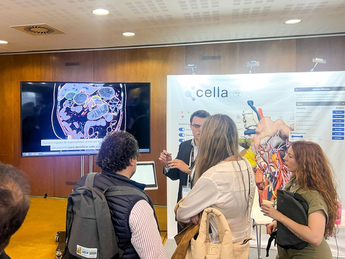 CellaMedical3D's tweet photo. 👏🏻🔝 ¡Cerramos con éxito nuestra participación en el XV Congreso de la @SECTtoracica y el XXVIII Congreso Nacional de la @AECP_FAECP!

Durante estos días, hemos compartido cómo la cirugía de precisión y la tecnología #3D están transformando la planificación de cirugías complejas. https://t.co/hcr2FHrNYP