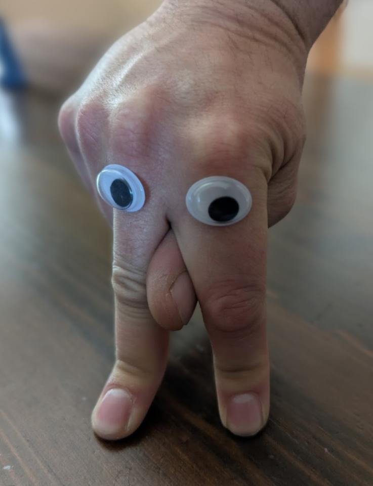 Just a retarded hand