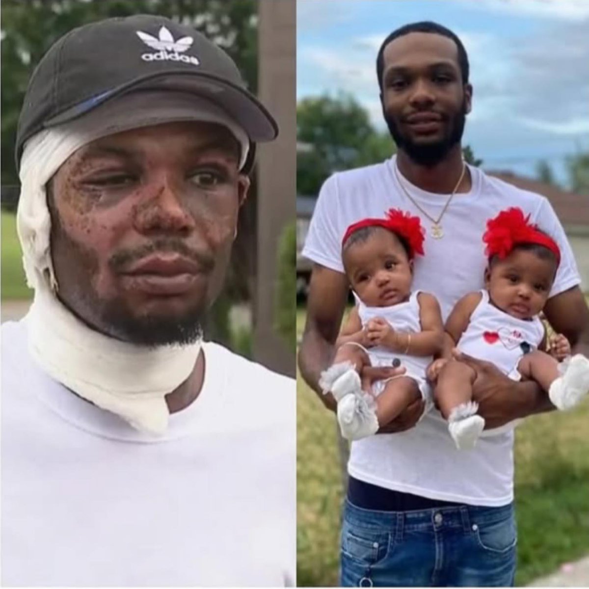 VulindlelaNdab2's tweet photo. International News!
Hero dad as Father Ray Lucas rushed into burning home to save his 18-month-old twin daughters, suffering severe burns himself. True bravery & unconditional love! ❤️ #HeroDad #SelflessAct #LoveOfAFather @father @fatherjohnmisty @clinicvoot @zanupfbyoarea1 https://t.co/y3G9O98XDJ