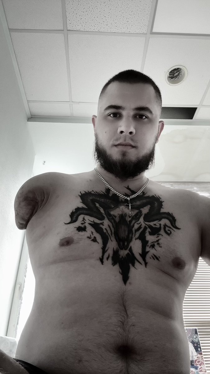‼️Потрібен максимальний ретвіт‼️🙏

Денис Петлюк втратив руку захищаючи нас з вами. Хлопець мріє повернутись до повноцінного життя. 

Зараз потребує складної операції по вживленню імпланта в кістку.

Реквізити:
send.monobank.ua/jar/2EkggF4Q5Q

PayPal:
endoprotezcentr@gmail.com