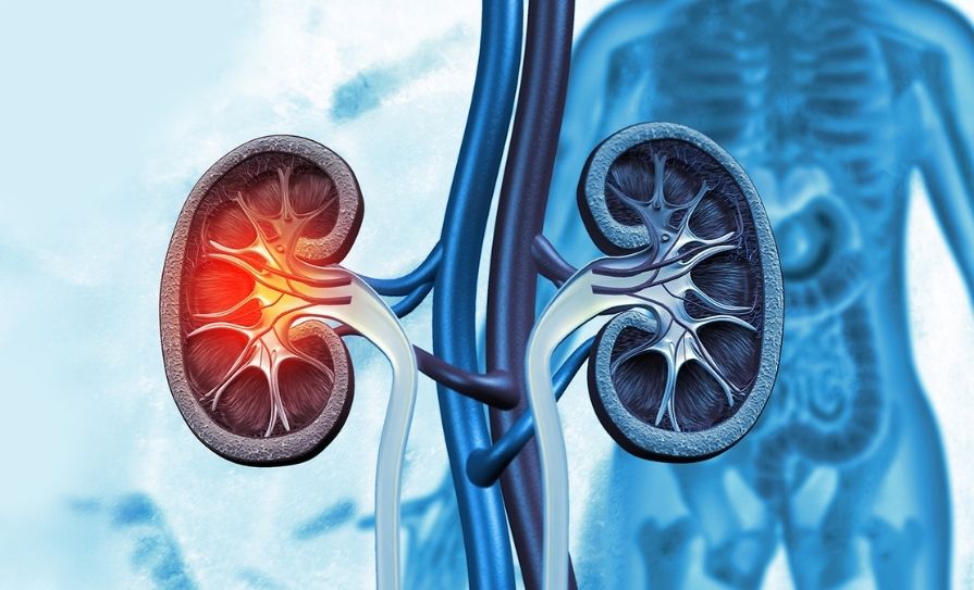 Medical Independent (@med_indonews) on Twitter photo ICU capacity needed to grow living kidney transplantation – NKTS
medicalindependent.ie/in-the-news/ic…
<a href="/Beaumont_Dublin/">Beaumont Hospital</a> <a href="/odti_irl/">Organ Donation Transplant Ireland</a> <a href="/IrishKidneyAs/">Irish Kidney Association</a> <a href="/ODNMteam/">ODNM-Organ Donation Nurse Manager</a> #organdonation ICU capacity needed to grow living kidney transplantation – NKTS
medicalindependent.ie/in-the-news/ic…
<a href="/Beaumont_Dublin/">Beaumont Hospital</a> <a href="/odti_irl/">Organ Donation Transplant Ireland</a> <a href="/IrishKidneyAs/">Irish Kidney Association</a> <a href="/ODNMteam/">ODNM-Organ Donation Nurse Manager</a> #organdonation