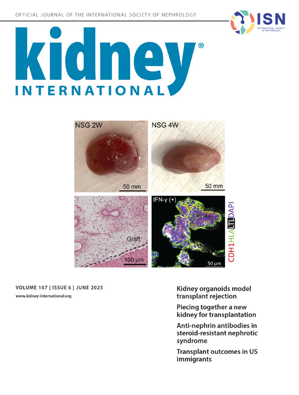 Int Society of Nephrology (@isnkidneycare) on Twitter photo ⚠ <a href="/Kidney_Int/">Kidney International</a> June issue is out!
Read the latest news in research, highlights from current literature, comprehensive reviews, and in-depth case studies kidney-international.org/current
Read the editor's pick for this month: ⚠ <a href="/Kidney_Int/">Kidney International</a> June issue is out!
Read the latest news in research, highlights from current literature, comprehensive reviews, and in-depth case studies kidney-international.org/current
Read the editor's pick for this month: