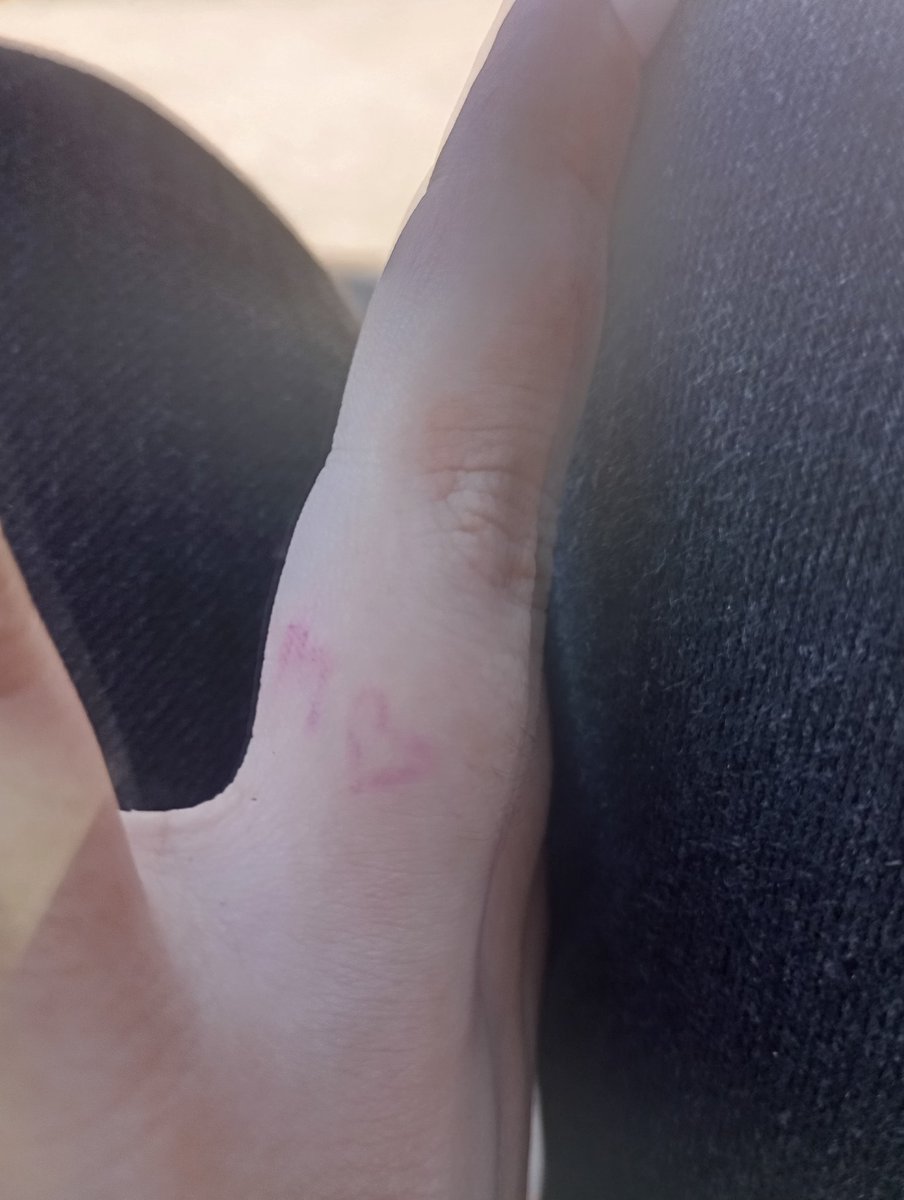 jackettyellow's tweet image. minha namorada já me marcou como posse dela (a gente não namora, nunca beijei ela e ela nem sabe que tô afim dela