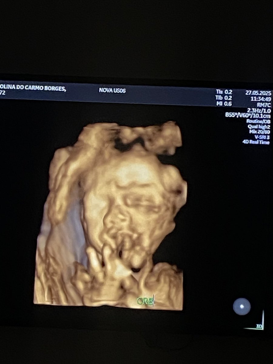 carolcborgesc's tweet photo. O amor da vida de mamãe, meu meninão. 
Claudinho 💚 https://t.co/0bQXCY2Nd0