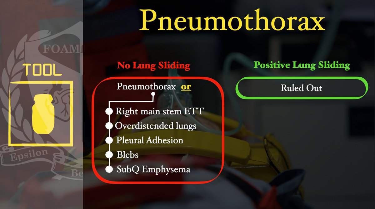 Pneumothorax Identification - Stethoscope vs POCUS