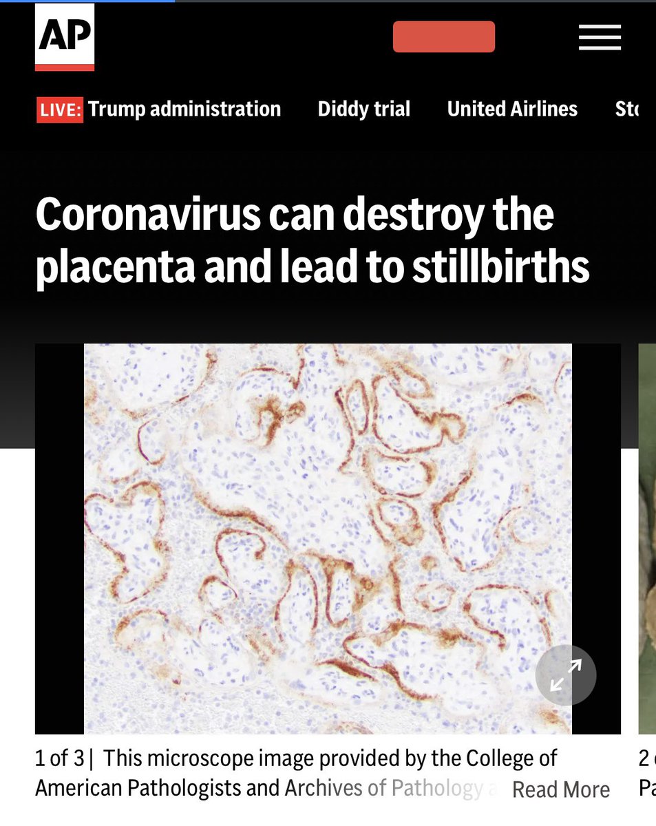 broadwaybabyto's tweet photo. “A CDC report found that among pregnant U.S. women infected with COVID-19, about 1 in 80 deliveries was a stillbirth — the loss of a fetus anytime after 20 weeks. That’s compared with 1 in 155 among uninfected women”

Pregnant women need access to Covid boosters. https://t.co/IswihfHzUe