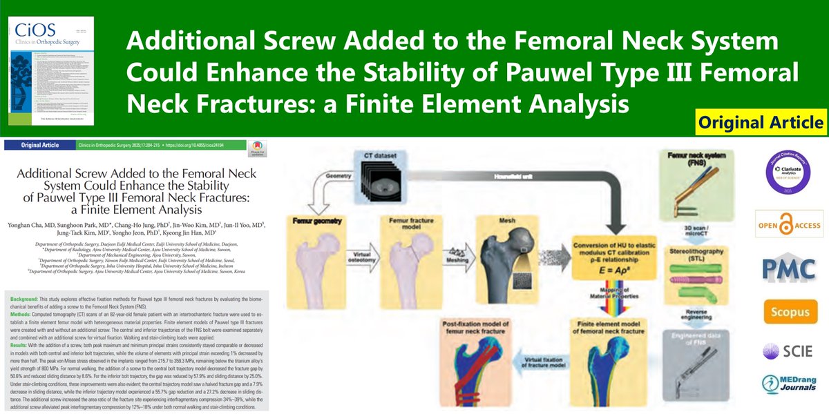 Additional Screw Added to the Femoral Neck System Could Enhance the Stability of Pauwel Type III Femoral Neck Fractures: a Finite Element Analysis
🌷doi.org/10.4055/cios24…
2025 Apr;17(2)Yonghan Cha
#Femoral_neck_fractures #Finite_element_analysis #Biomechanical_phenomena