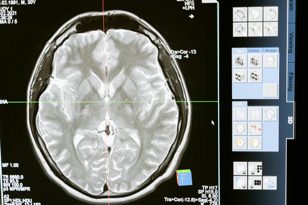 Life Course & Aging (@lifecourseuoft) on Twitter photo New #technology allows healthcare providers to identify those at risk of #Alzheimer’s even before symptoms emerge, representing a significant advancement in the early detection of #cognitiveimpairment <a href="/EurekAlert/">EurekAlert!</a> eurekalert.org/news-releases/… New #technology allows healthcare providers to identify those at risk of #Alzheimer’s even before symptoms emerge, representing a significant advancement in the early detection of #cognitiveimpairment <a href="/EurekAlert/">EurekAlert!</a> eurekalert.org/news-releases/…