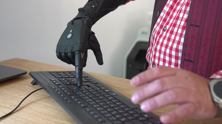 Bürgeranwalt
Warum zahlt die PVA notwendige Prothese nicht?

Michael G. beantragte vor einem Jahr eine myoelektrische Unterarmprothese mit Greiffunktion bei der Pensionsversicherungsanstalt. Im Sommer...

on.orf.at/video/14276208…

#ORFbuergeranwalt #Volksanwalt #PVA #Prothese