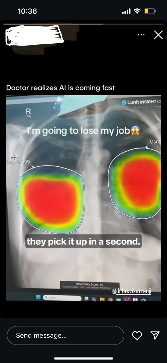 ashokux's tweet photo. Came across this in Instagram AI fear is democratically spread across, but doctors??? Why? Doctor’s role is more human to human support than the technicals. And same theory applies to all industries, every job has a skill set that is connected to human empathy. #AI #Humanempathy https://t.co/N0eesfIRP9